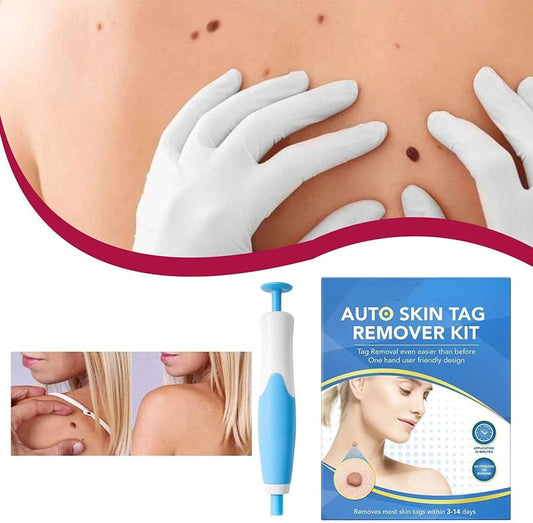 Skin Tags Remover Kit,2 in 1 Natural Mild Wart Removal Kit - Multifunctional Painless Auto Skin Tags Band Remover Pen for Hands, Feet, Shoulders, Necks, Legs