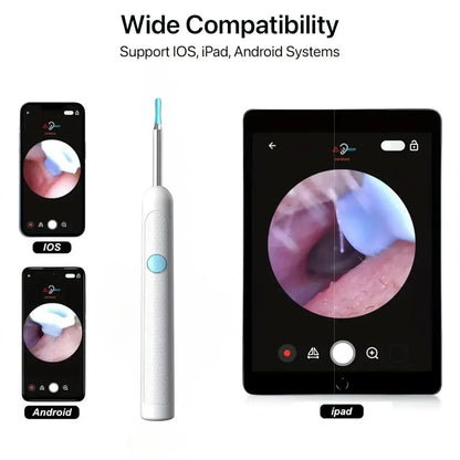 Ear wax cleaner tool kit with 1080P camera WIFI & LED Light Rechargeable portable Baby Children adults gift gadget for IOS & Android